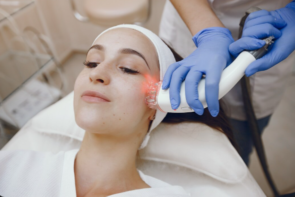 BBL Laser – A Revolutionary Treatment for Skin Rejuvenation