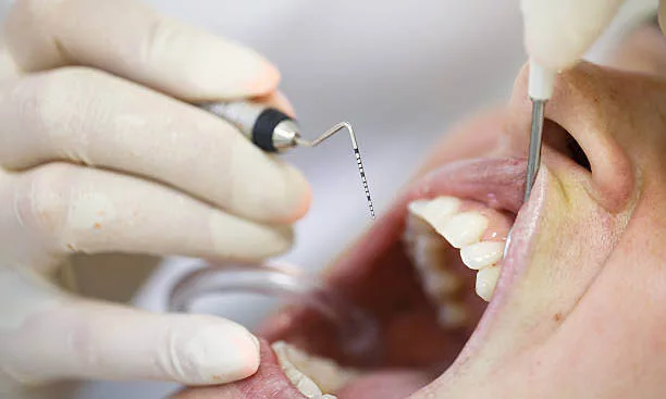 How to Fix Receding Gums: Treatment Guide