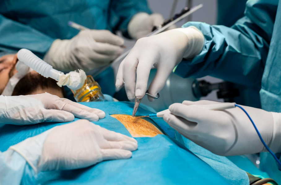 Minimally Invasive Approaches for Gallbladder Cancer Treatment