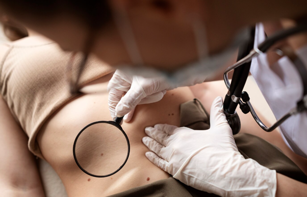 Keloid Scar Treatment Malaysia Options for Difficult Raised Skin