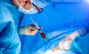 Is Stem Cell Banking Worth It? Here’s What Doctors and Parents Are Saying in 2026