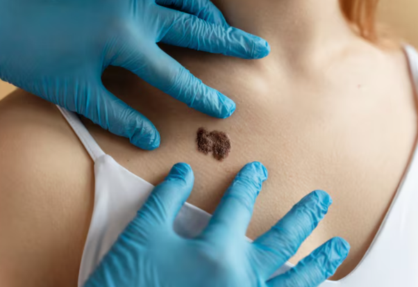 Advanced Keloid Scar Treatment and Lip Enhancement Solutions Available