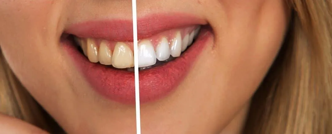 Symptoms: It’s Time to Go to a Bad Breath Clinic Symptoms: It’s Time to Go to a Bad Breath Clinic