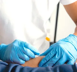 Dry Needling
