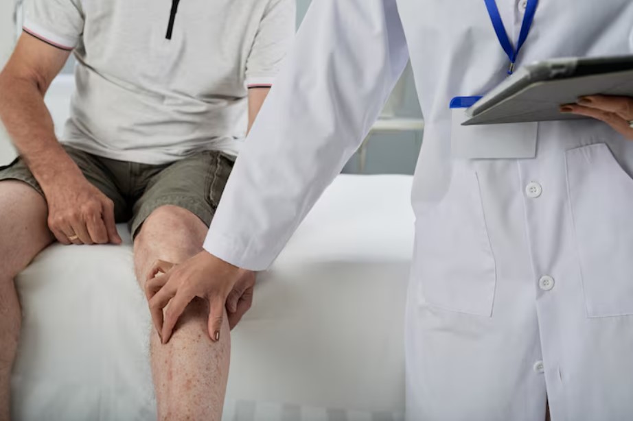 Managing Severe Arthritis: When Knee Replacement Surgery Becomes An Option Managing Severe Arthritis: When Knee Replacement Surgery Becomes An Option
