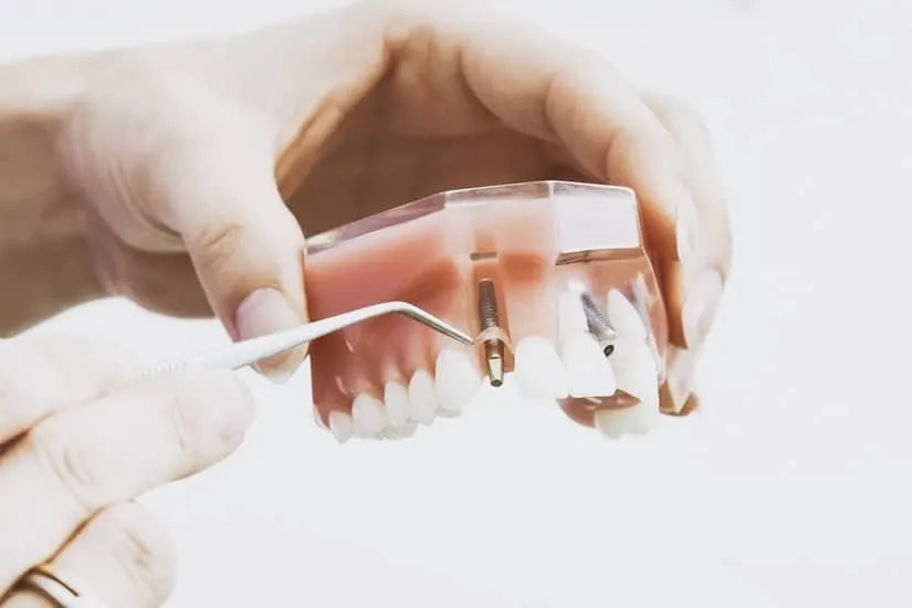 Factors for Choosing a Family Dental Clinic For Complete Oral Care Solutions Factors for Choosing a Family Dental Clinic For Complete Oral Care Solutions