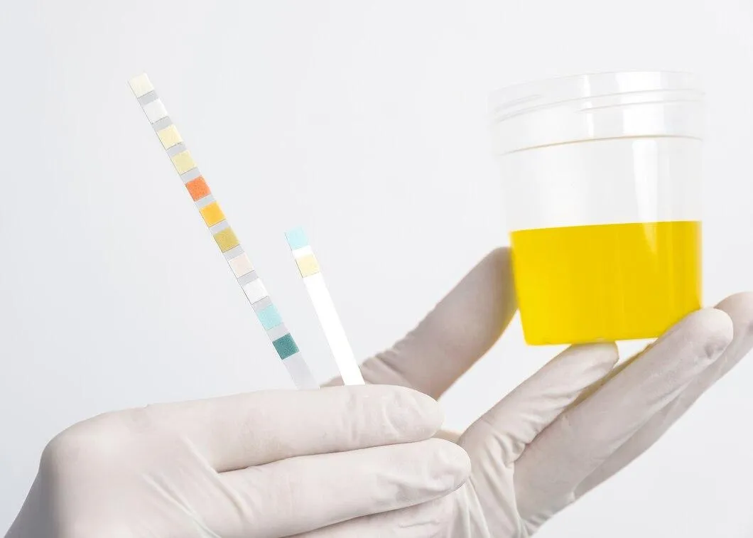 Synthetic Urine Supports Safer Medical Diagnostic in Drug Test Issues